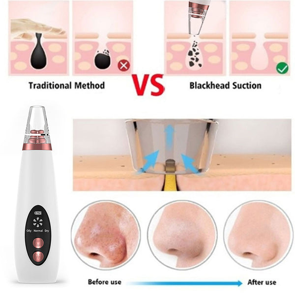 Blackhead Remover Pore Vacuum Cleaner - Upgraded Blackhead Suction Tool With Display-USB Rechargeable Facial Pore Cleanser 6 Replaceable Suction Probes For All Skin